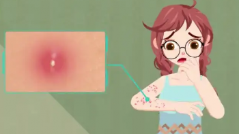 玫瑰痤疮的科学治疗：南京专家带您走出误区！